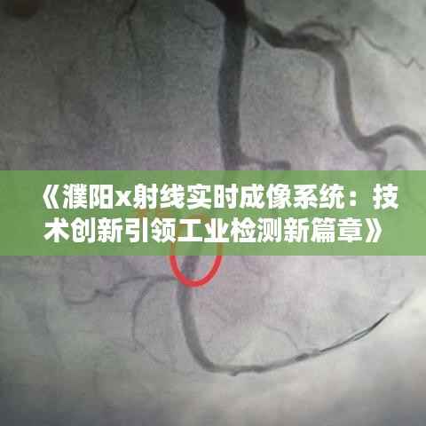 《濮阳x射线实时成像系统：技术创新引领工业检测新篇章》