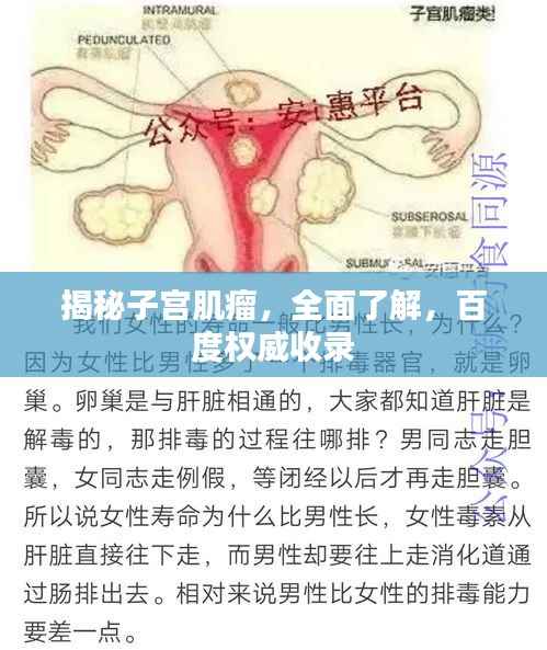揭秘子宫肌瘤,全面了解,百度权威收录