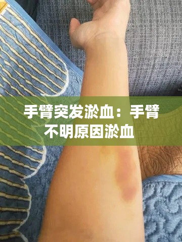 手臂突发淤血:手臂不明原因淤血