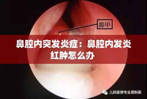 鼻腔内突发炎症:鼻腔内发炎红肿怎么办