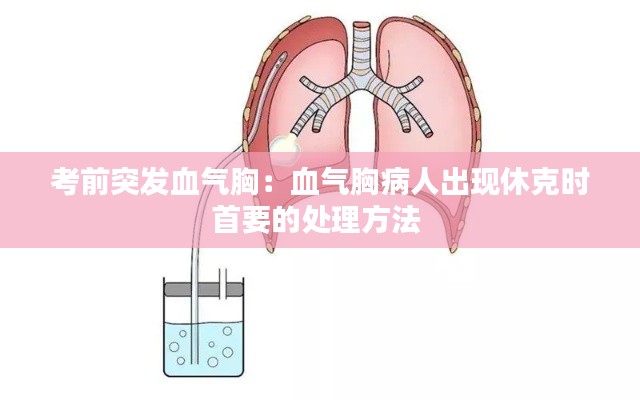 考前突发血气胸：血气胸病人出现休克时首要的处理方法 