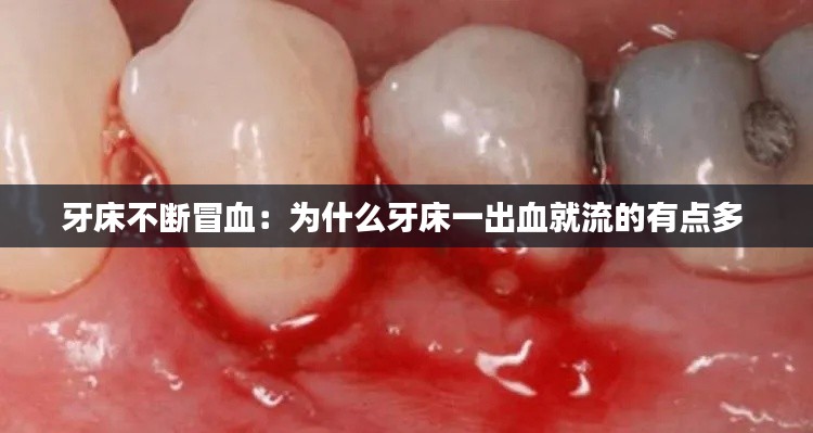 牙床不断冒血:为什么牙床一出血就流的有点多