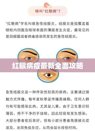 红眼病症最新全面攻略