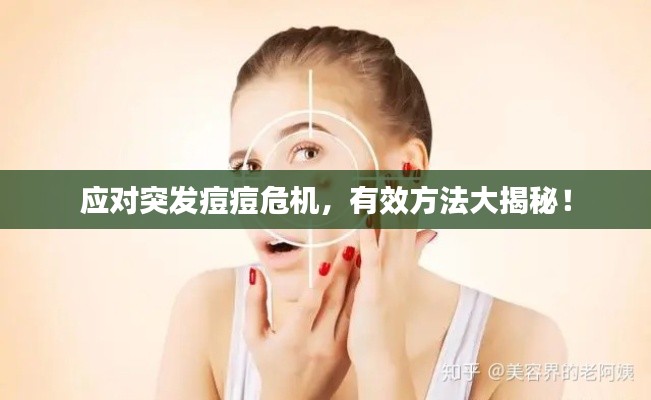 应对突发痘痘危机,有效方法大揭秘!