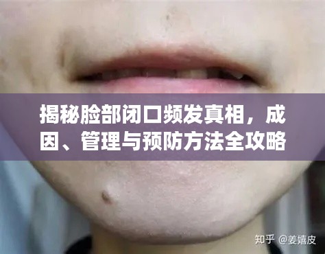 揭秘脸部闭口频发真相,成因、管理与预防方法全攻略