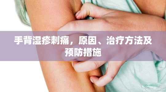 手背湿疹刺痛，原因、治疗方法及预防措施