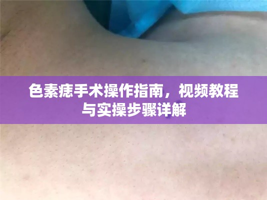 色素痣手术操作指南，视频教程与实操步骤详解