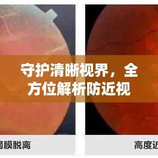 守护清晰视界,全方位解析防近视专题