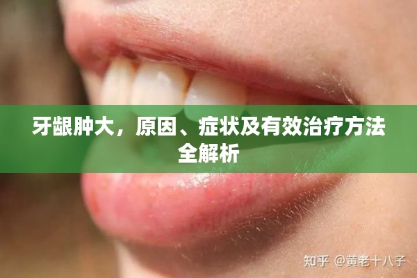 牙龈肿大，原因、症状及有效治疗方法全解析
