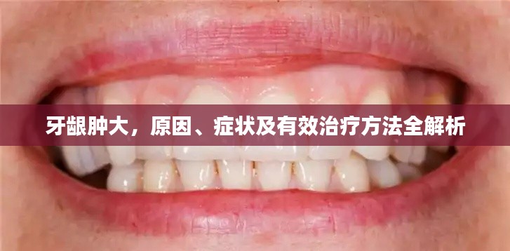 牙龈肿大,原因、症状及有效治疗方法全解析