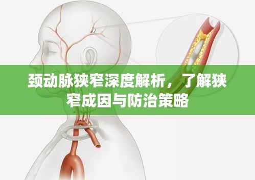 颈动脉狭窄深度解析,了解狭窄成因与防治策略